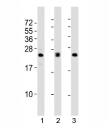 Western blot testing of FGF2 antibody at 1:2000 dilution; Lane 1: human A549 lysate, 2: mouse heart lysate; 3: rat lung lysate. Predicted molecular weight: 17-31 kDa (multiple isoforms).