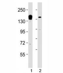 Western blot testing of KDM6A antibody at 1:2000 dilution. Lane 1: human liver lysate; 2: HeLa lysate; Predicted molecular weight ~ 154 kDa.