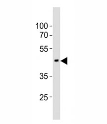 Western blot testing of EED antibody at 1:1000 dilution + mouse brain lysate; Predicted molecular weight: 50 kDa (isoform 1), 53 kDa (isoform 2), 46 kDa (isoform 3).