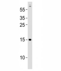 Western blot testing of Gabarapa antibody at 1:500 dilution + zebrafish lysate; Predicted molecular weight : 14 kDa.
