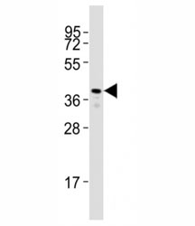 Western blot testing of Rho antibody at 1:2000 dilution + zebrafish muscle lysate; Predicted molecular weight: 40 kDa.