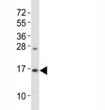 Western blot testing of LC3B antibody at 1:2000 dilution + mouse brain lysate; Predicted band size : 15 kDa.