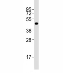 Western blot testing of Pou5f1 antibody at 1:2000 dilution + F9 lysate; Predicted molecular weight ~38/30kDa (isoform A/B), commonly observed at 38-45 kDa.