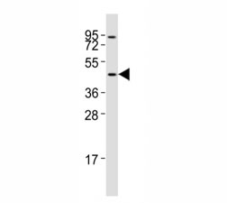 Western blot testing of CCR1 antibody at 1:2000 dilution + Jurkat whole cell lysate; Predicted molecular weight: 40-45 kDa.