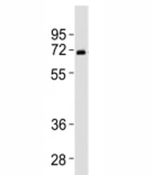Western blot testing of SPHK2 antibody at 1:2000 dilution + human liver lysate. Predicted molecular weight ~69 kDa.