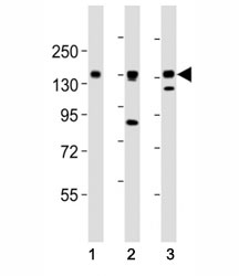 AXL antibody at 1:2000 dilution. Lane 1: NCI-H1299 lysate; 2: HeLa lysate; 3: L6 lysate; Predicted molecular weight is 104 kDa unglycosylated, 120-140 kDa with glycosylation