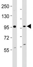 Western blot testing of EZH2 antibody at 1:2000 dilution. Lane 1: mouse F9 lysate; 2: human K562 lysate; Predicted band size : 95 kDa.