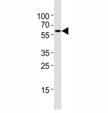 Western blot testing of Atg5 antibody at 1:4000 dilution + NIH3T3 lysate; ATG5: ~32 kDA; ATG5/ATG12 heterodimer: ~56 kDa
