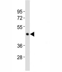 Western blot testing of Caspase-4 antibody at 1:2000 dilution + human Raji lysate; Expected molecular weight ~43 kDa (precursor), ~30 kDa (pro + large subunit), ~20 kDa (large subunit).