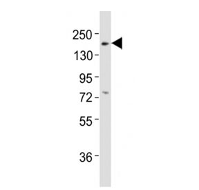 Western blot testing of Erbb3 antibody at 1:2000 dilution + mouse lung lysate; Predicted band size : 148 kDa.