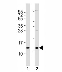 Western blot testing of CXCL12 antibody at 1:2000 dilution. Lane 1: human heart lysate; 2: mouse kidney lysate; Predicted molecular weight: 9-12 kDa.