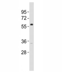 Western blot testing of VANGL2 antibody at 1:2000 dilution + DU145 lysate; Predicted molecular weight ~60 kDa.
