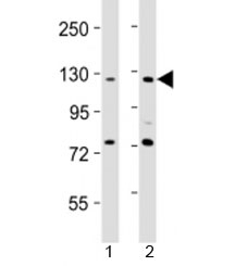 Western blot testing of AATK antibody at 1:2000 dilution. Lane 1: HeLa lysate; 2: NIH3T3 lysate; Predicted band size : 145 kDa.