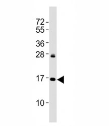 Western blot testing of p16INK4a antibody at 1:2000 dilution + HeLa lysate; Predicted molecular weight: 17 kDa.