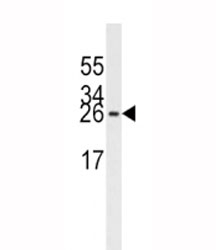 EIF4E antibody western blot analysis in Jurkat lysate. Predicted molecular weight ~27 kDa.