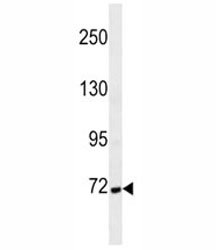Cortactin antibody western blot analysis in MDA-MB231 lysate. Molecular weight: routinely observed at ~80kDa.