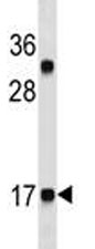 CGRP antibody western blot analysis in HL-60 lysate