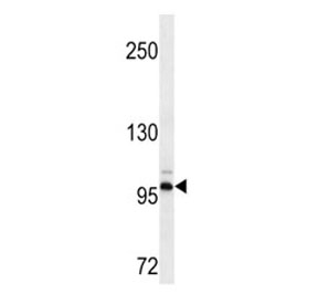 DDR2 antibody western blot analysis in HepG2 lysate. Predicted molecular weight: 97-116 kDa.