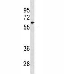 CYP1A2 antibody western blot analysis in SK-BR-3 lysate. Predicted molecular weight ~58 kDa.