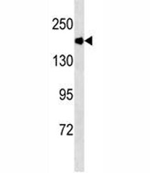 ACE antibody western blot analysis in mouse kidney tissue lysate. Expected molecular weight 140-170 kDa.
