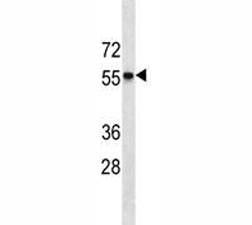 CCR7 antibody western blot analysis in HL-60 lysate. Predicted size ~45 kDa