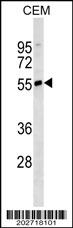 IGHD antibody western blot analysis in CEM lysate