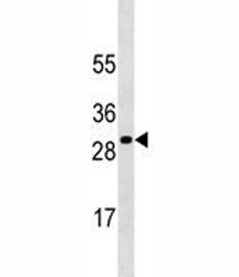 SOCS3 antibody western blot analysis in HepG2 lysate. Predicted molecular weight ~24kDa.