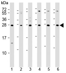 Western blot testing of 1) mouse EL4, human 2) fetal thymus, 3) spleen, 4) HUT78, 5) Jurkat and 6) Molt-4 lysate with TIGIT antibody. Predicted molecular weight ~26 kDa.