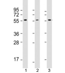 Western blot testing of 1) human MCF7, 2) human Jurkat and 3) rat PC-12 cell lysate with AKT2 antibody at 1:2000. Predicted molecular weight: 56 kDa.
