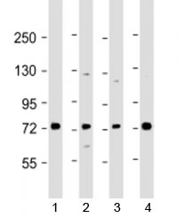 Western blot testing of human 1) Raji, 2) A549, 3) HL-60 and 4) K562 cell lysate with SKI antibody at 1:2000. Predicted molecular weight: 80 kDa.