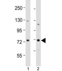 Western blot testing of human 1) MCF-7 and 2) T47D cell lysate with ERVK-9 antibody at 1:2000. Predicted molecular weight: 79 kDa.