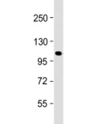 Western blot testing of mouse NIH3T3 cell lysate with GLI1 antibody at 1:2000. Expected molecular weight: 100~160 kDa.