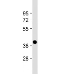 Western blot testing of human heart lysate with NMNAT1 antibody at 1:2000. Predicted molecular weight: 32 kDa, commonly observed at 28-36 kDa.