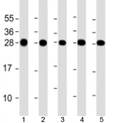 Western blot testing of human 1) HeLa, 2) Jurkat, 3) MCF-7, 4) U-2OS and 5) A431 cell lysate with RPL14 antibody at 1:2000. Predicted molecular weight: 23 kDa.