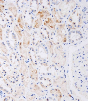 IHC staining of FFPE human kidney tissue with NAT8L antibody. HIER: boil tissue sections in pH 9 10mM Tris with 1mM EDTA for 20 min and allow to cool before testing.