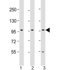Western blot testing of human 1) HepG2, 2) PC-3 and 3) U-87 MG cell lysate with PCDH10 antibody at 1:2000. Predicted molecular weight: 113 kDa.