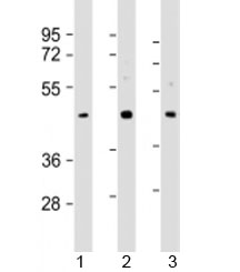 Western blot testing of human 1) HepG2, 2) MCF-7 and 3) PC-3 cell lysate with SAPCD2 antibody at 1:2000. Predicted molecular weight: 43 kDa.