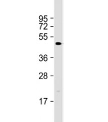 Western blot testing of human SW480 cell lysate with DEDD2 antibody at 1:1000. Predicted molecular weight: 36 kDa.