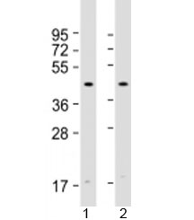 Western blot testing of human 1) HeLa and 2) Jurkat cell lysate with Atrogin 1 antibody at 1:2000. Predicted molecular weight: 42 kDa.