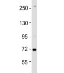 Western blot testing of HeLa cell lysate with ZDHHC17 antibody at 1:1000. Predicted molecular weight: 73 kDa.