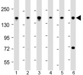 Western blot testing of human 1) 293T/17, 2) DU-145, 3) LNCaP, 4) Raji, 5) U-2OS and 6) HeLa cell lysate with PDS5B antibody at 1:2000. Predicted molecular weight: 165 kDa.