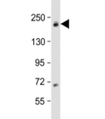 Western blot testing of human MCF-7 cell lysate with USP32 antibody at 1:1000. Predicted molecular weight: 182 kDa.