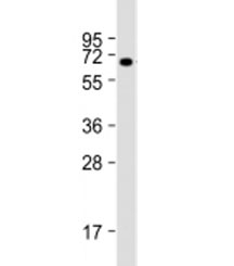 Western blot testing of human kidney lysate with BANP antibody at 1:2000. Predicted molecular weight: 56 kDa, observed here at ~70 kDa.