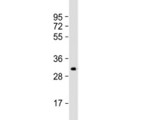 Western blot testing of human SK-OV-3 cell lysate with IGFBP5 antibody at 1:2000. Predicted molecular weight: 31 kDa.