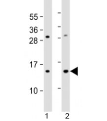 Western blot testing of 1) human HL-60 and 2) mouse Neuro-2a cell lysate with EIF1 antibody at 1:2000. Predicted molecular weight: 13 kDa.