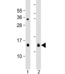Western blot testing of 1) mouse heart and 2) rat spleen lysate with YPEL3 antibody at 1:2000. Predicted molecular weight: 14 kDa.