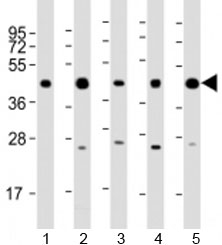 Western blot testing of human 1) 293T/17, 2) A431, 3) HeLa, 4) Jurkat and 5) K562 cell lysate with PHF6 antibody at 1:2000. Predicted molecular weight: 41 kDa.