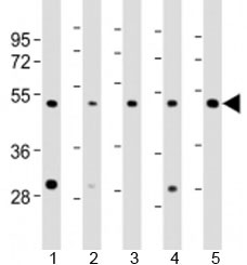 Western blot testing of human 1) HeLa, 2) HT-1080, 3) Jurkat, 4) LNCaP and 5) PC-3 cell lysate with LASS4 antibody at 1:2000. Predicted molecular weight: 46 kDa.