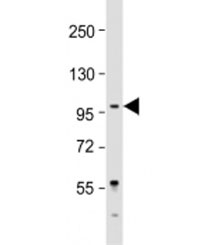 Western blot testing of Jurkat cell lysate with LARGE antibody at 1:2000. Predicted molecular weight: 88 kDa.