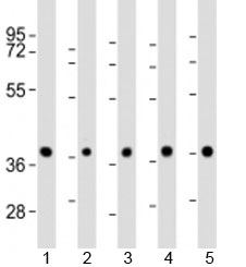 Western blot testing of 1) mouse BA/F3 cell lysate and human 2) HeLa, 3) K562, 4) MCF-7 and 5) Raji cell lysate with PPP2R4 antibody at 1:2000. Expected molecular weight: 37/41/33/32 kDa (alpha/beta/delta/epsilon isoforms).
